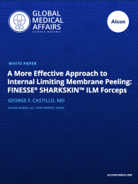 A More Effective Approach to Internal Limiting Membrane Peeling: FINESSE® SHARKSKIN™ ILM Forceps