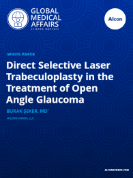 Direct Selective Laser Trabeculoplasty in the Treatment of Open Angle Glaucoma
