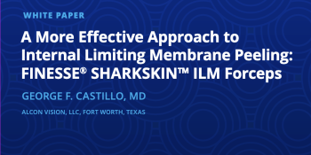 A More Effective Approach to Internal Limiting Membrane Peeling: FINESSE® SHARKSKIN™ ILM Forceps