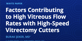 Factors Contributing to High Vitreous Flow Rates with High-Speed Vitrectomy Cutters